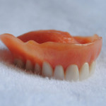 Upper Denture