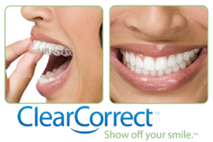 Correct Your Teeth Using ClearCorrect