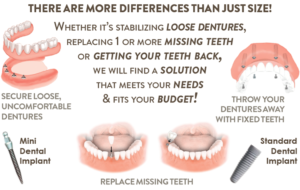 Key Contributions of MDI Dental Implants